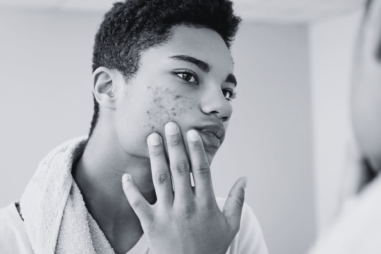 How to Achieve Clearer Skin: Your Comprehensive Acne Treatment Guide - Age To Perfection