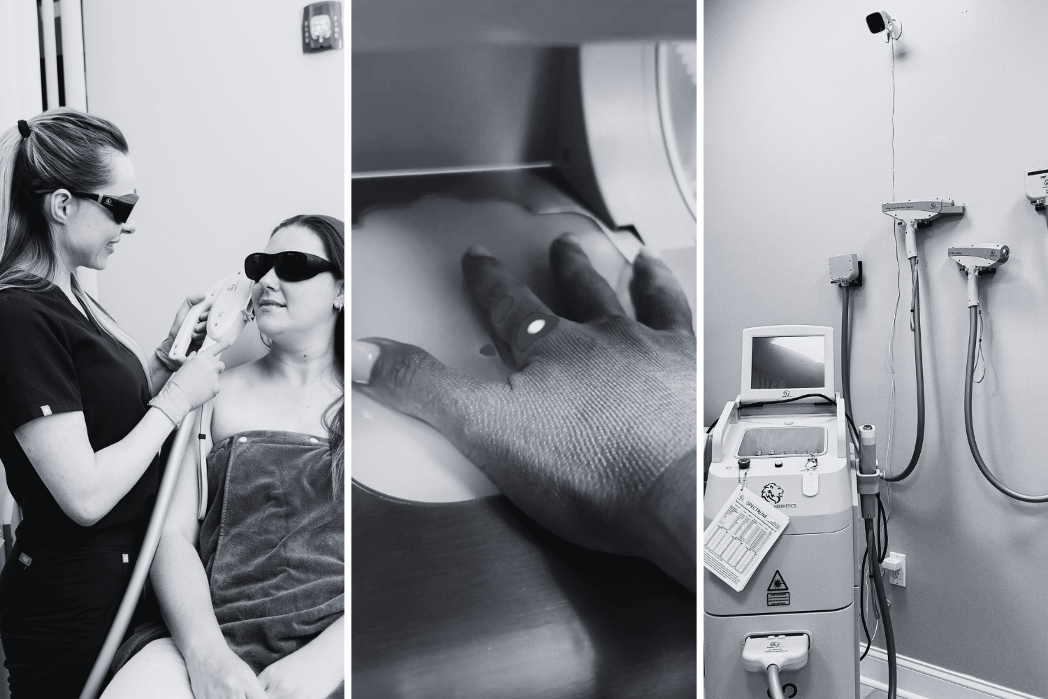 Did You Know? We Offer the Most Laser Skin Treatments in Coral Springs, Florida! - Age To Perfection