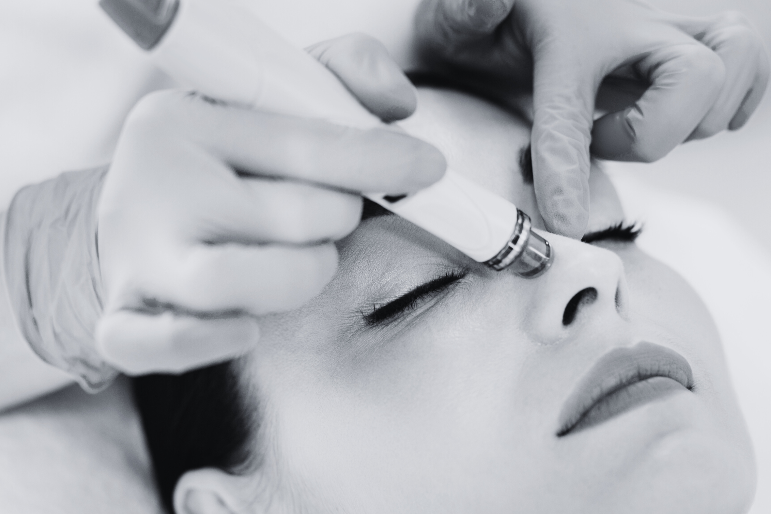 Beat the Heat: How Hydrafacials Can Keep Your Skin Clear This Summer