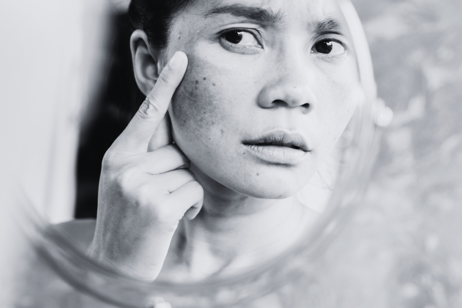 Spring Glow-Up: Say Goodbye to Dark Spots & Hello to Radiant Skin