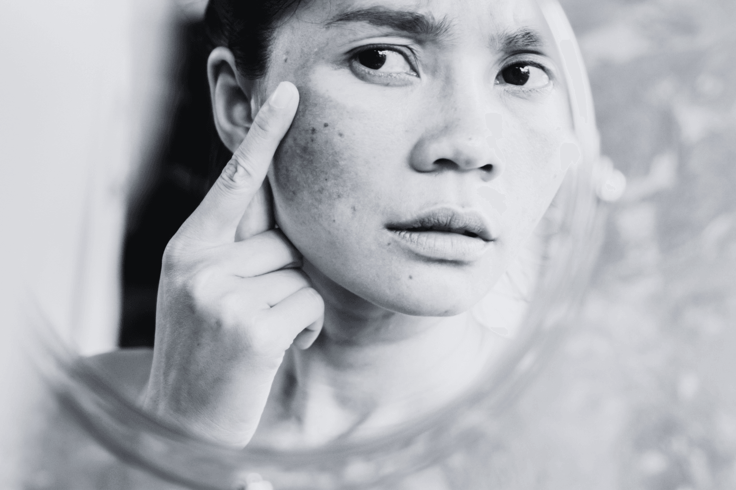 Spring Glow-Up: Say Goodbye to Dark Spots & Hello to Radiant Skin - Age To Perfection