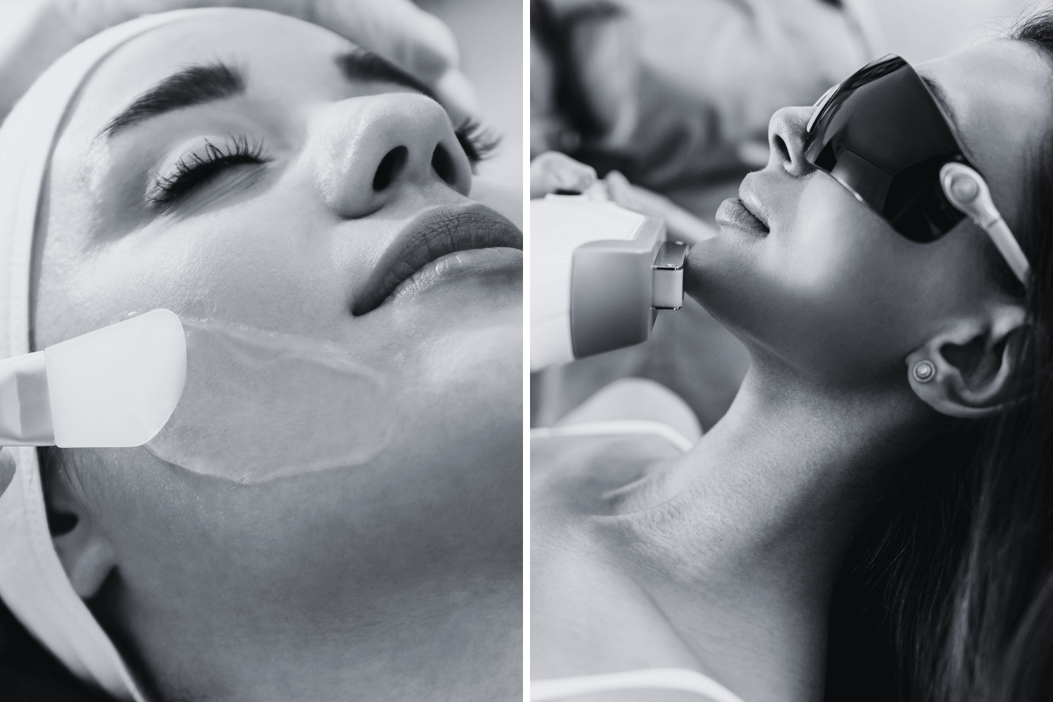 Restoring Your Skin Post-Summer: IPL and Chemical Peels for a Fresh Start - Age To Perfection